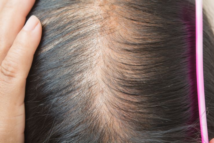 Hair&scalp