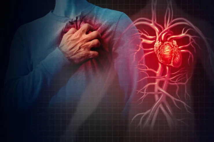 Heart Stroke------16