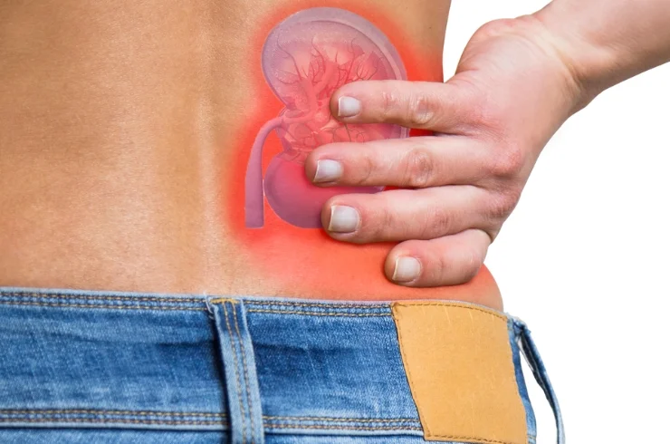 Kidney Disease------16